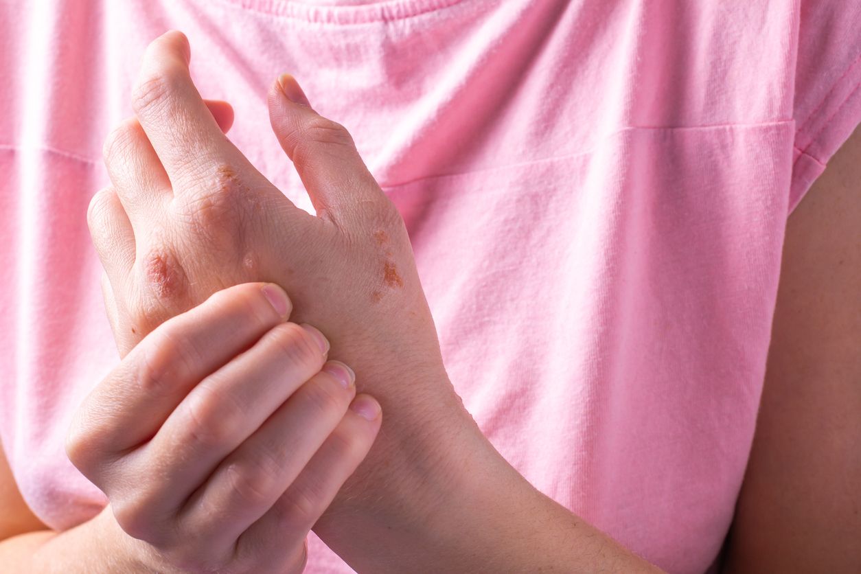 Der rheumatische Formenkreis umfasst bis zu 400 verschiedene Krankheitsformen.