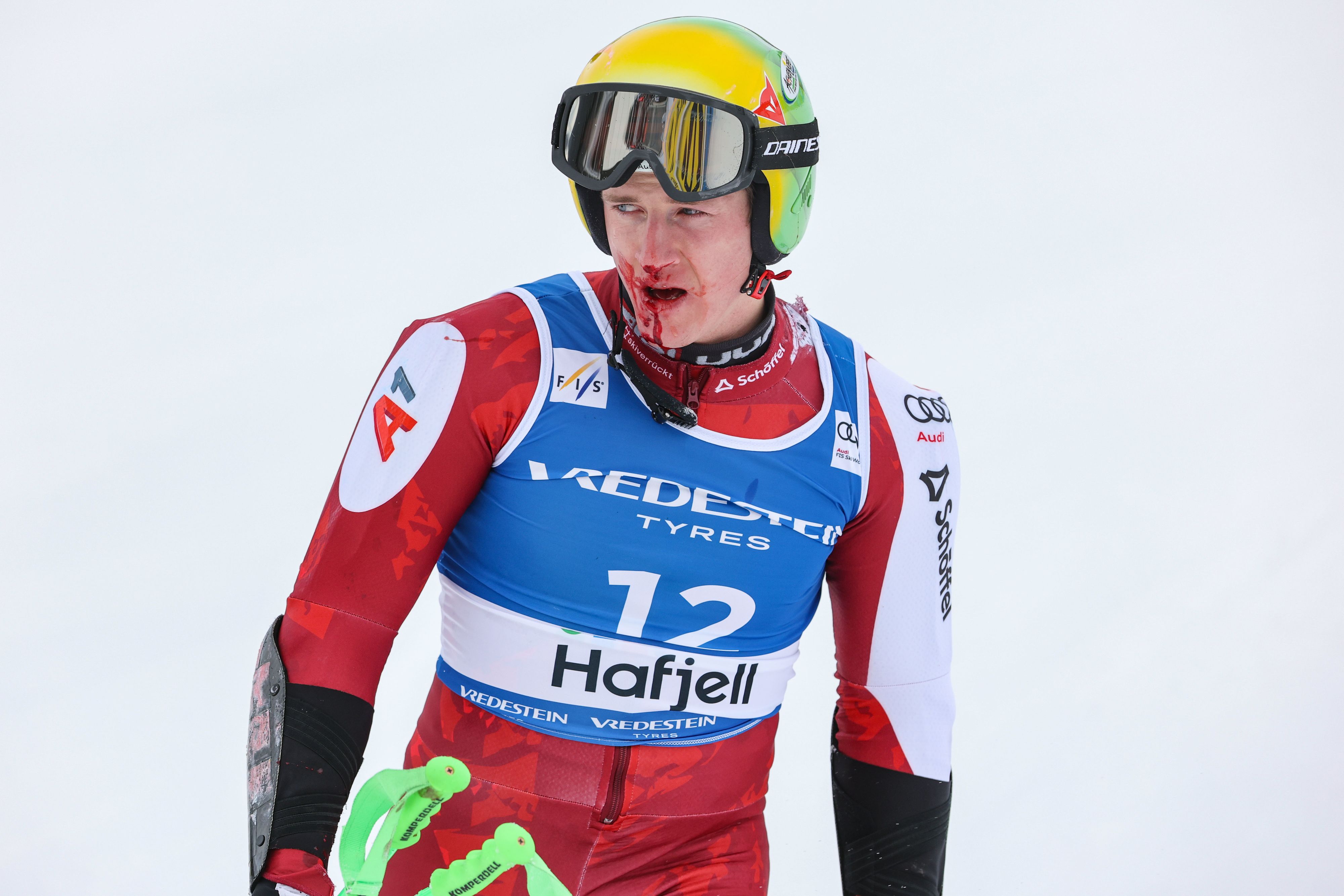 Raphael Haaser verletzte sich in Hafjell im Gesicht.