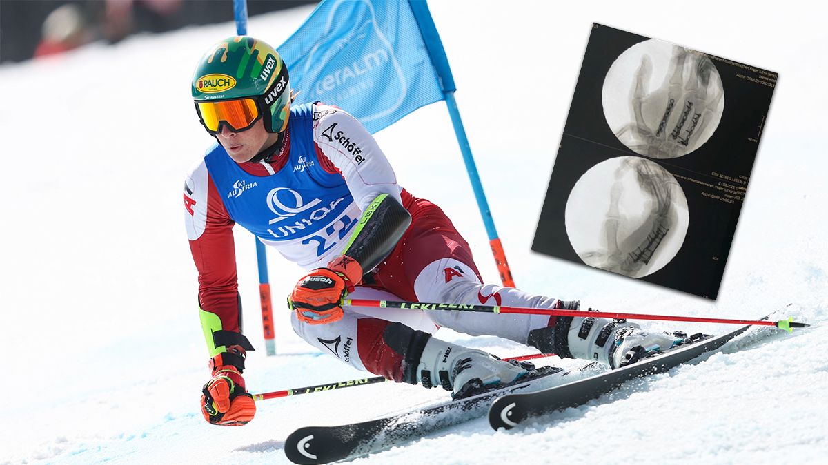 ÖSV-Hoffnung Zudrell musste seine Saison vorzeitig beenden.