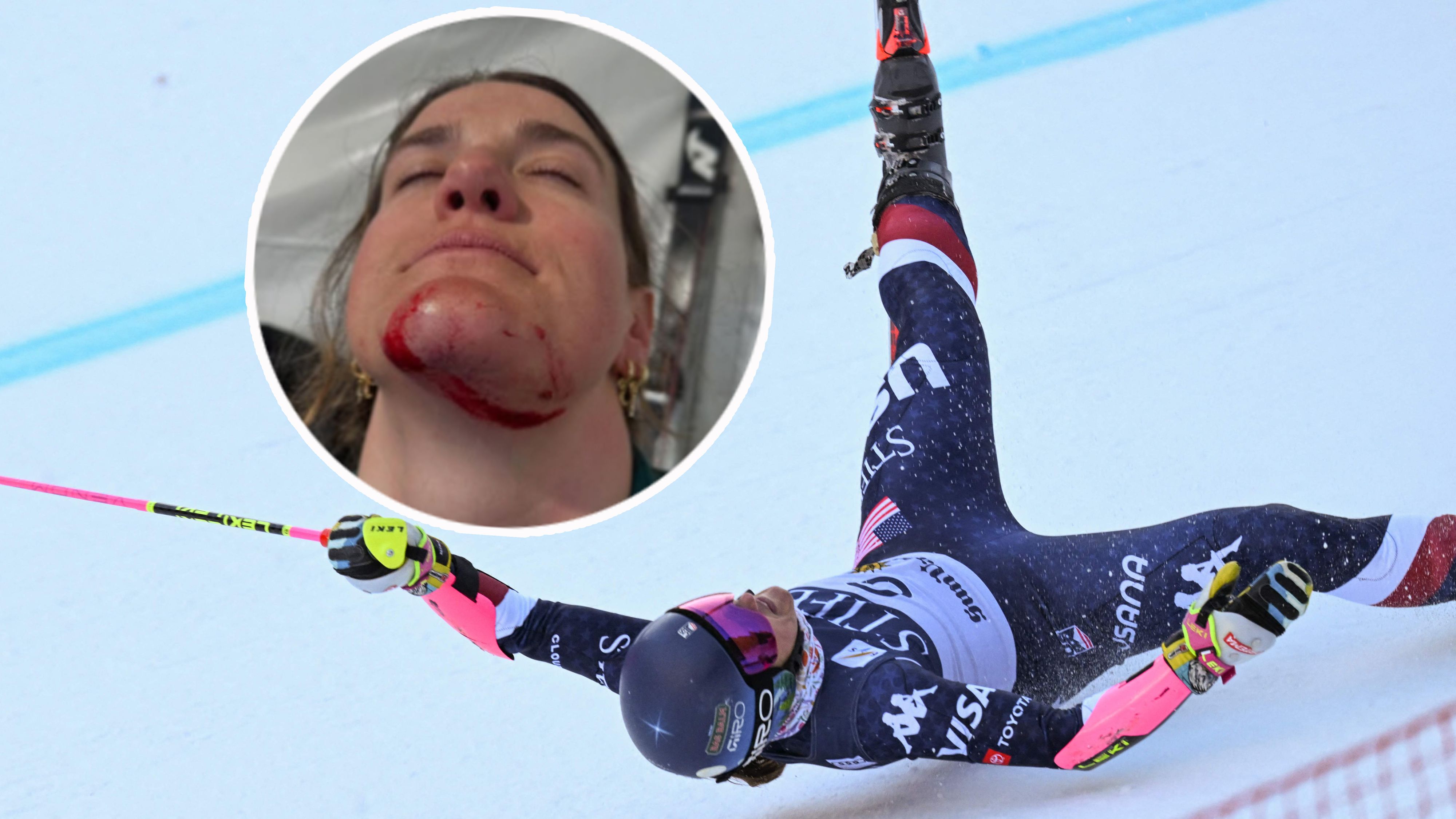 Paula Moltzan stürzte in Sun Valley schwer.