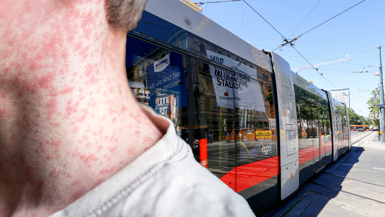 Der Bub fuhr mit der Straßenbahn zum Arzt. (Symbolbild)