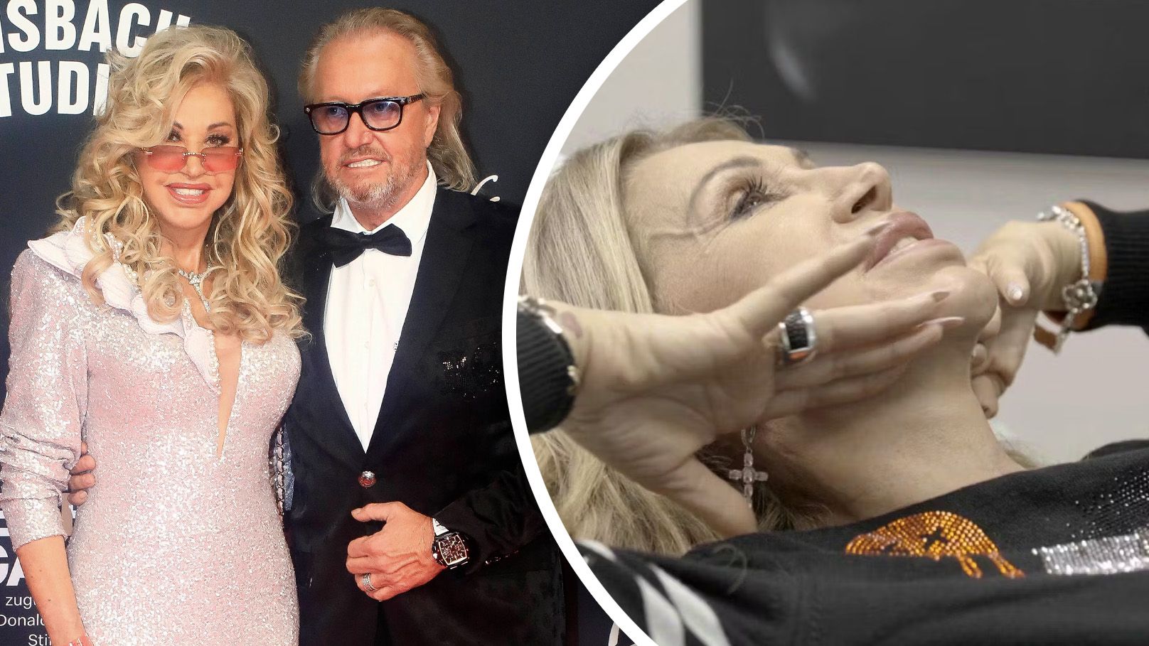 Carmen Geiss hat sich unters Messer gelegt.