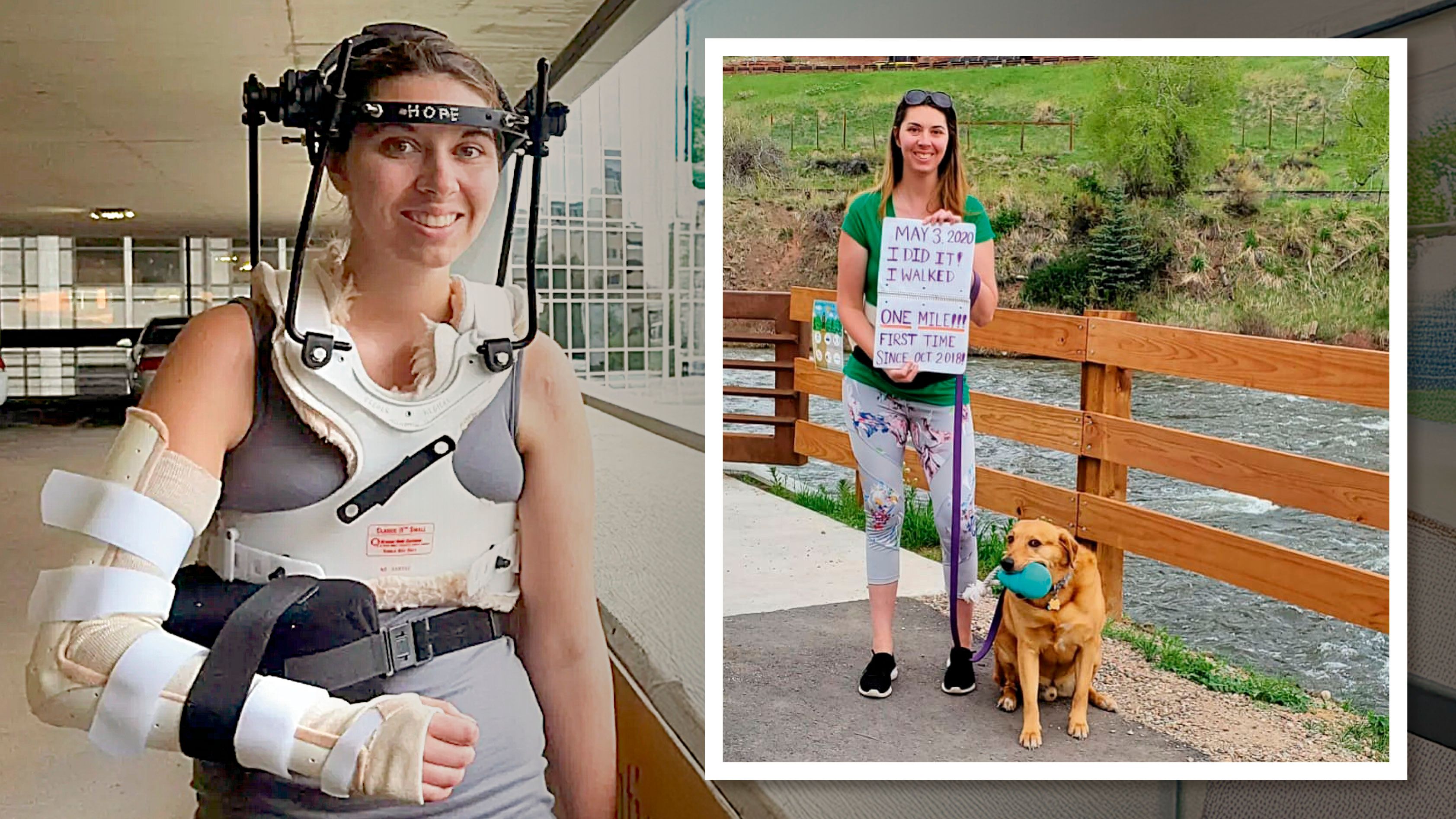 Willensstark kämpfte sich Megan King (35) nach ihrem Unfall vor 20 Jahren (l.) ins Leben zurück