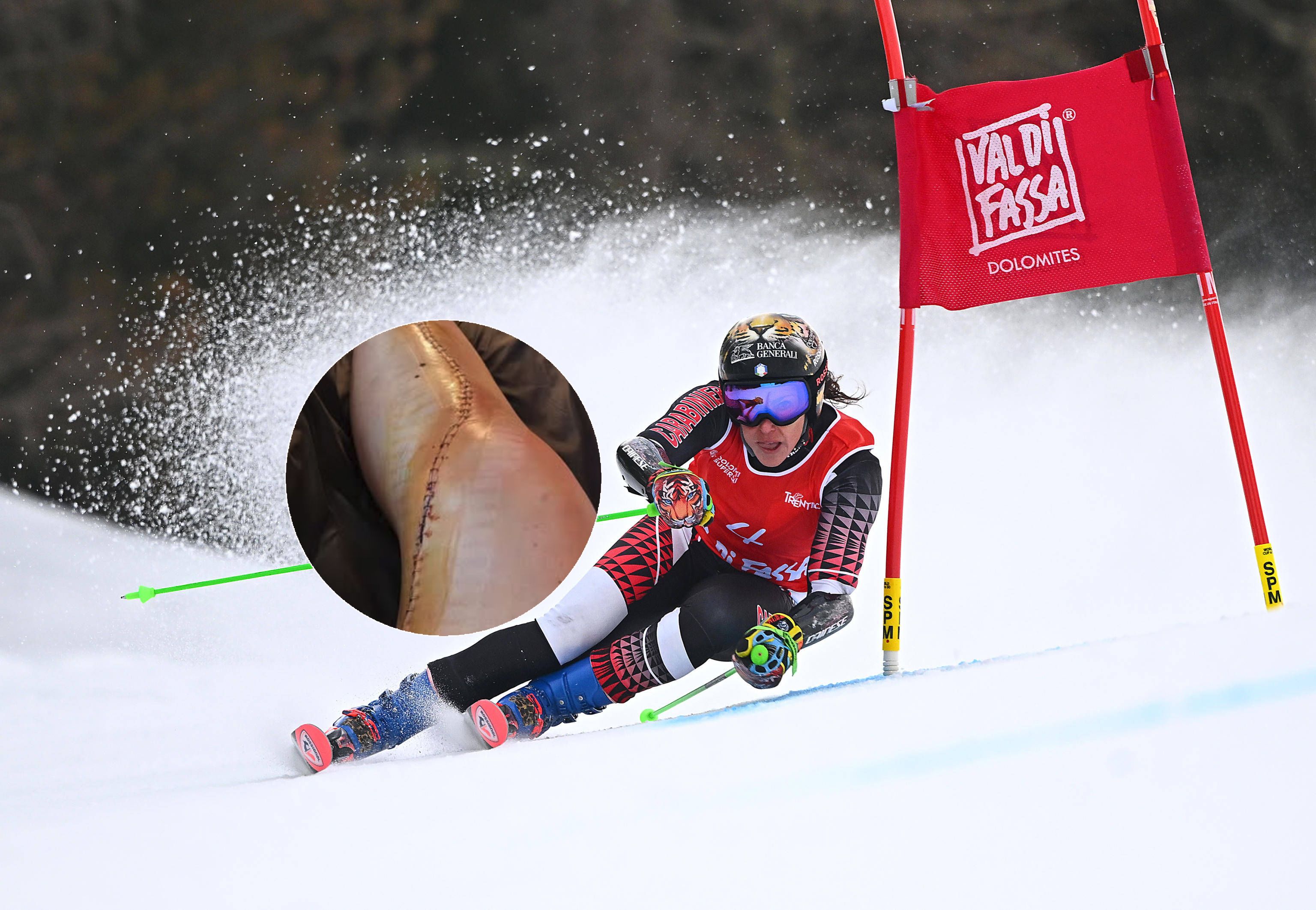 Federica Brignone zeigt ihr operiertes Bein.