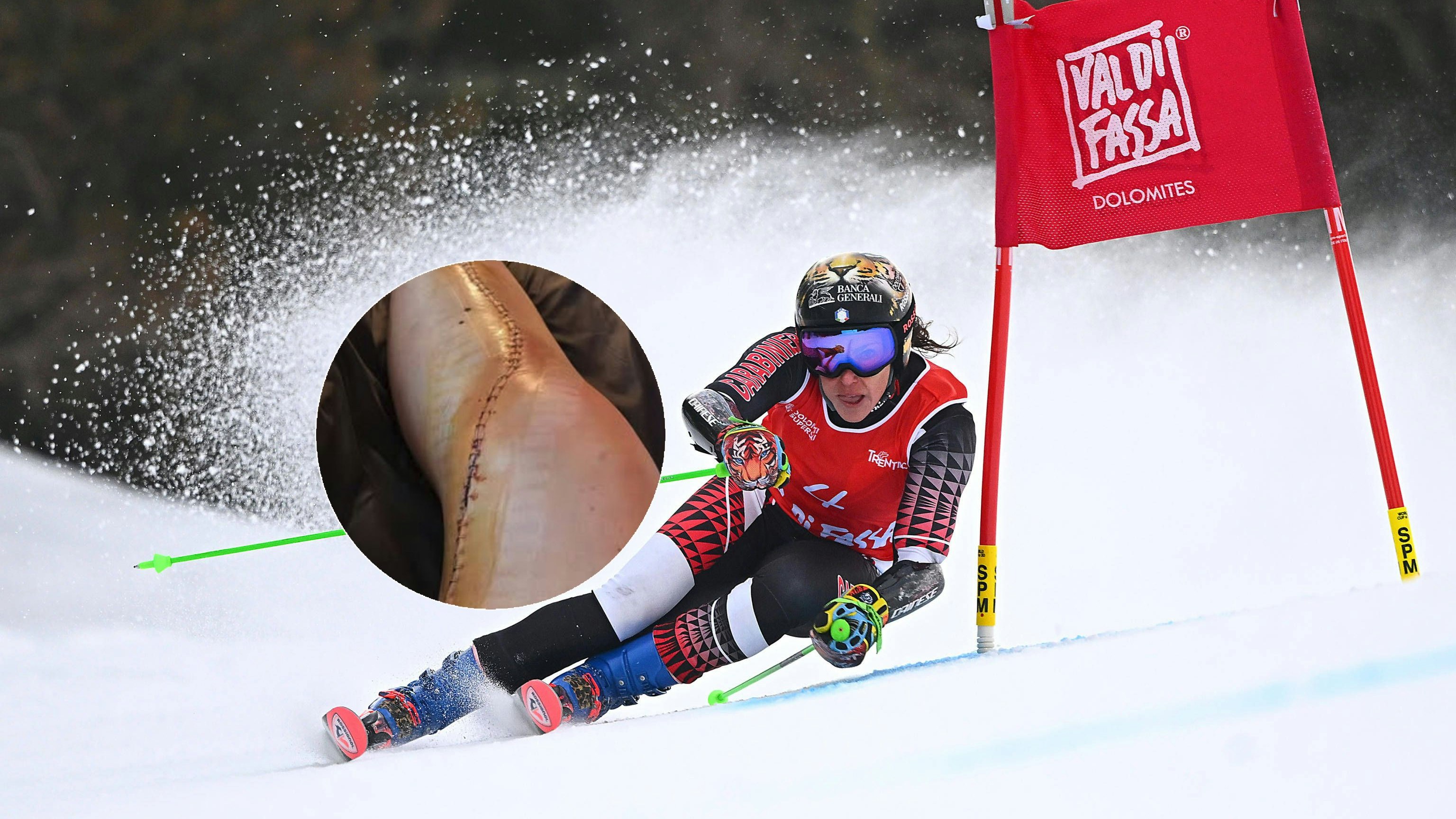 Federica Brignone zeigt ihr operiertes Bein.