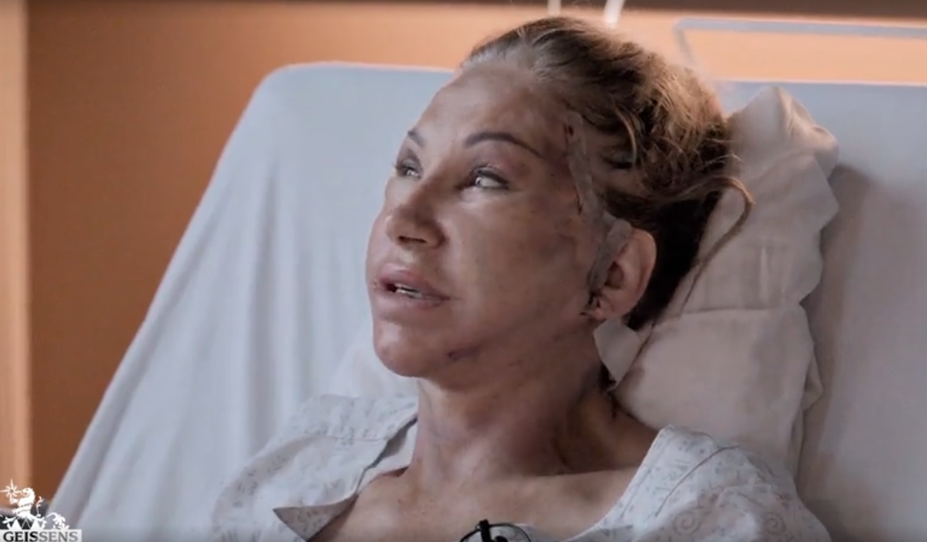 Carmen Geiss zeigt ihr neues Gesicht.