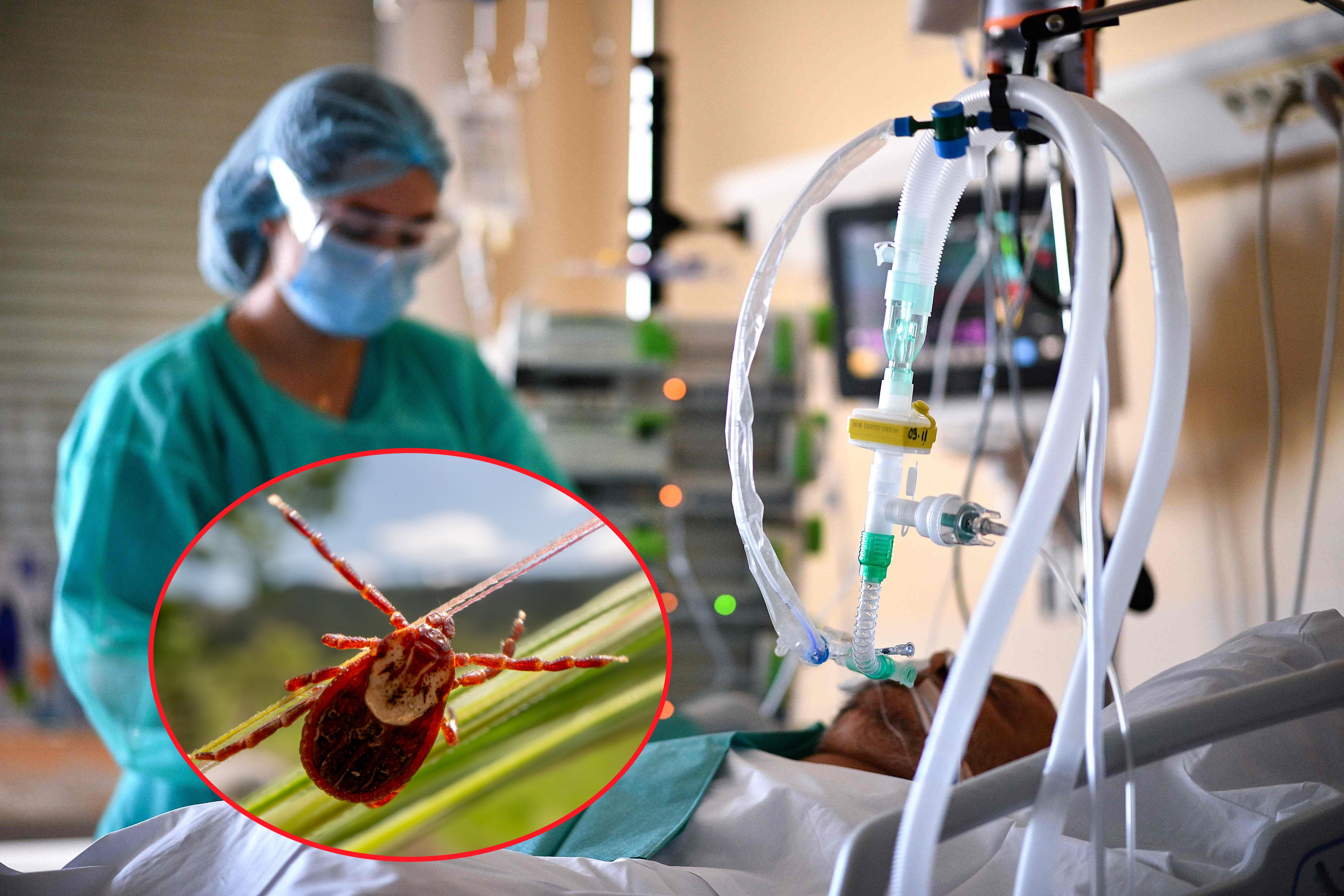 Mehr als die Hälfte der Betroffenen erkrankt schwer an Frühsommer-Meningoenzephalitis.