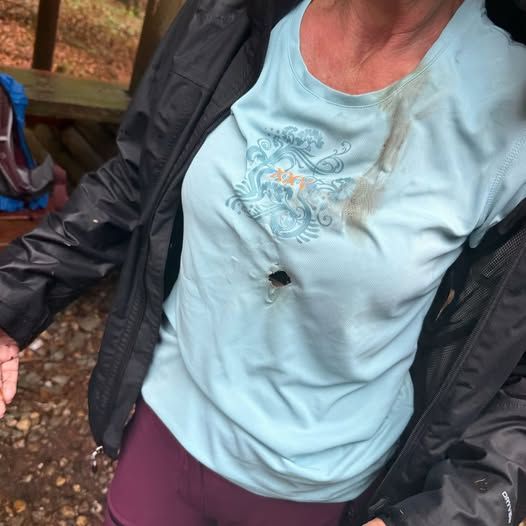 Zwei deutsche Touristen wurden in Tschechien vom Blitz getroffen. Am T-Shirt erkennt man genau, wo der Blitz eingeschlagen ist. 