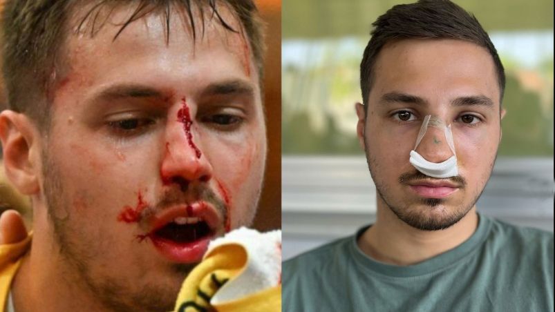 Markus Mahr mit der frischen Wunde auf dem Platz, nach der Not-OP in Feldkirch.