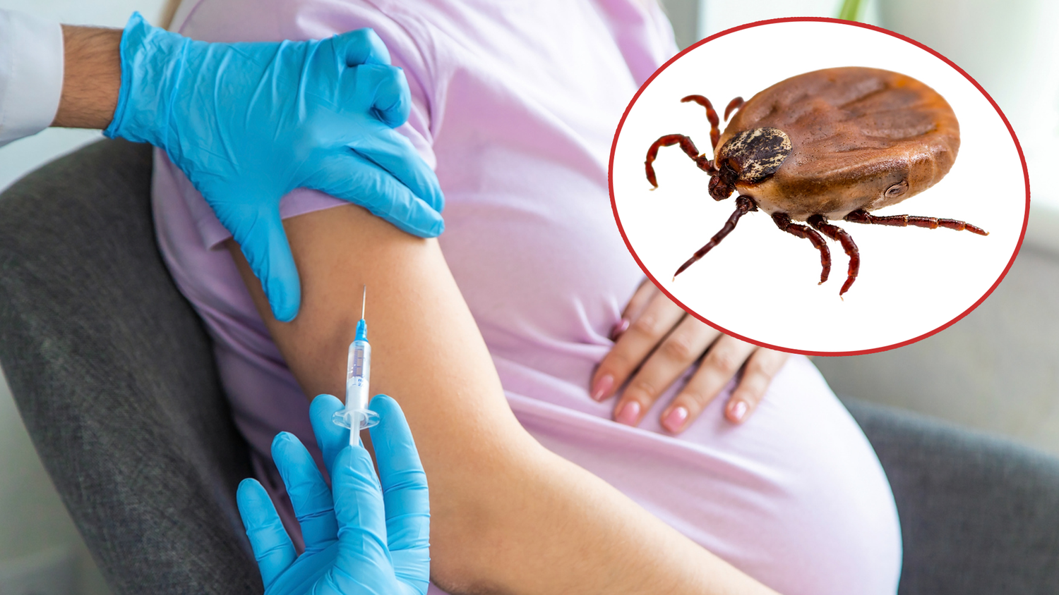 Auch Schwangere sollten ihren Zecken-Impfstatus im Auge haben.