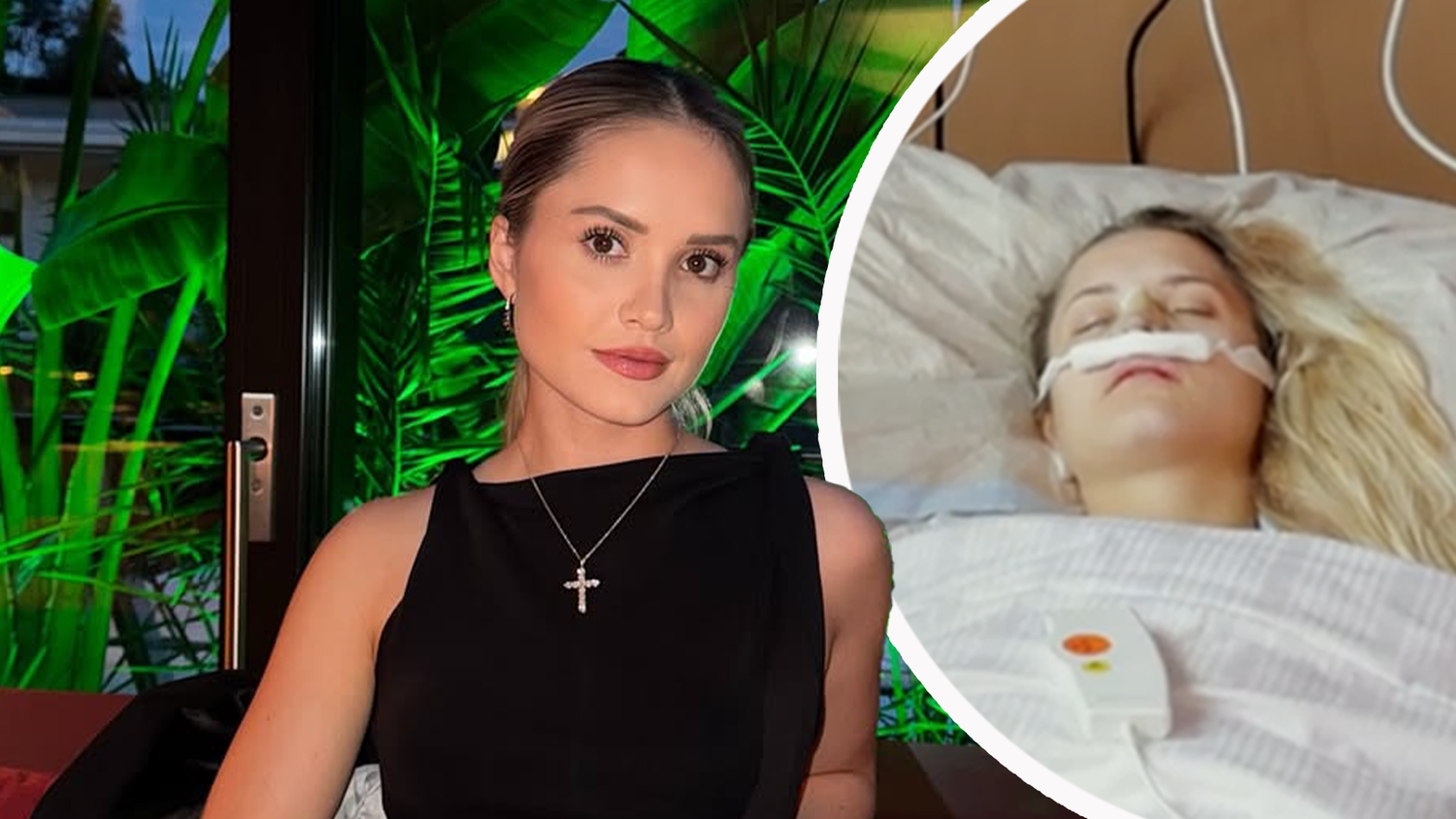 Davina Geiss hat ihre erste Schönheitsoperation hinter sich.