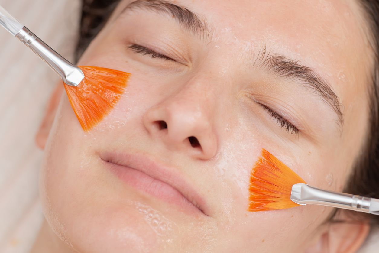 Die Popularität der chemischen Peelings steigt enorm.