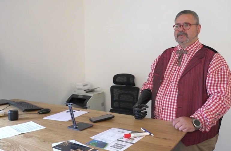 Michael G. durfte die Prothese mit Greiffunktion zwei Wochen lang testen.