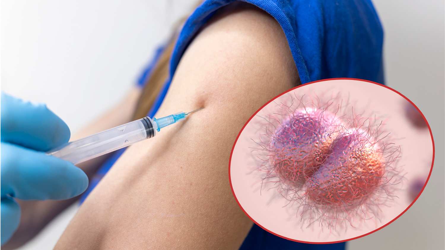 Der Impfstoff ist nur zu 30-40 % wirksam, aber England hofft, dass er die steigenden Infektionszahlen umkehren wird.