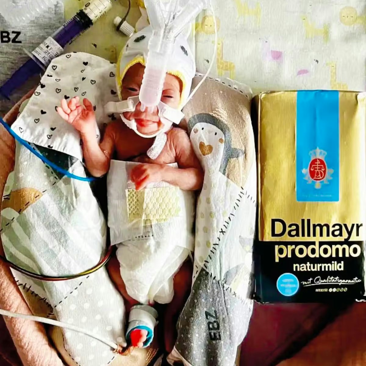 Sie ist das leichteste überlebende Frühchen Bayerns und zählt weltweit zu den kleinsten je geborenen Mädchen