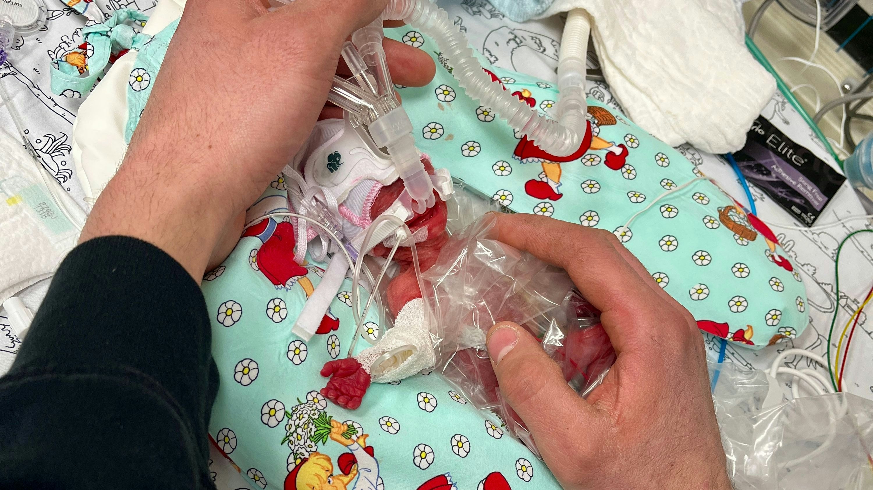 Der Vater begrüßt seine Tochter Marie gleich nach der Geburt