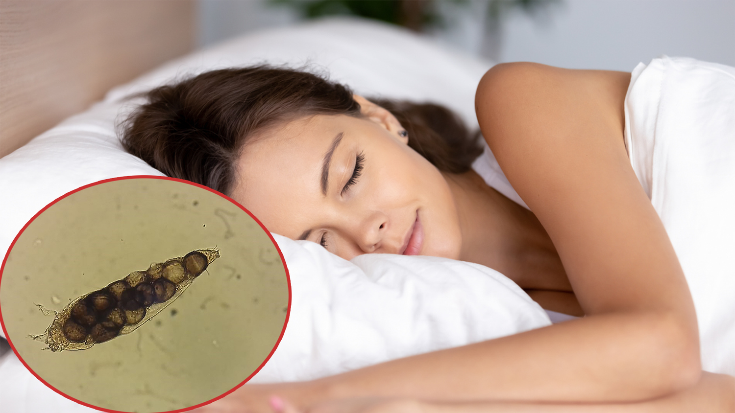 Die Demodex-Milben (kl. Bild) sind nachtaktiv.