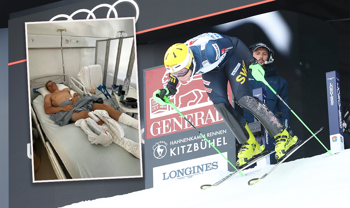 Axel Lindqvist hat sich im Training einen Unterschenkelbruch zugezogen. 