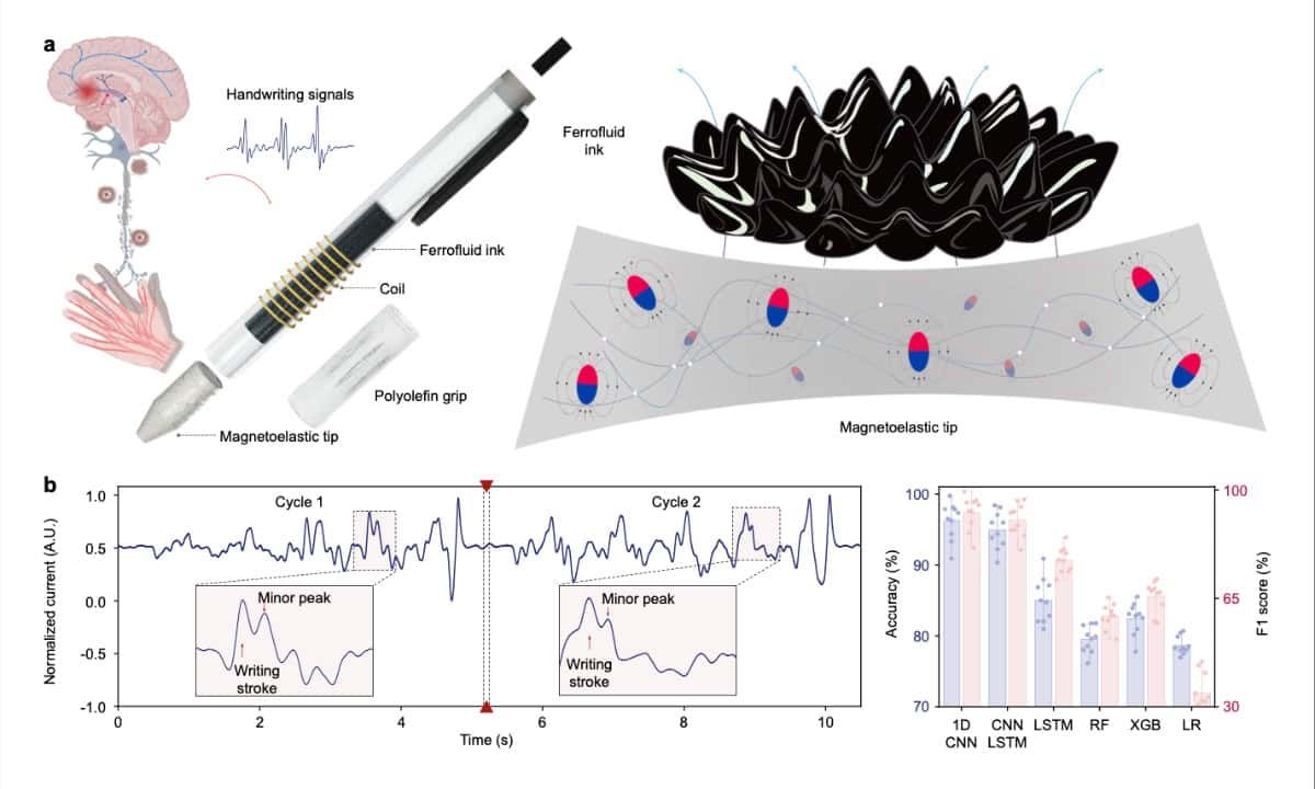 Ein neuer Smart Pen der UCLA erkennt Parkinson – nach ersten Tests mit großer Genauigkeit.