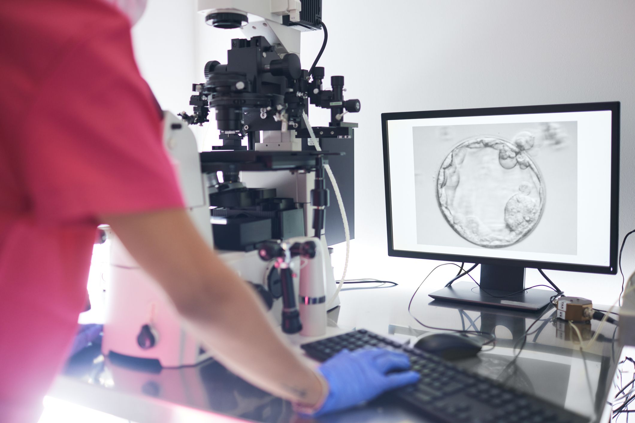 Eine Mutter soll ohne ihr Wissen mit Fremdsamen injiziert worden sein. (Symbolbild)