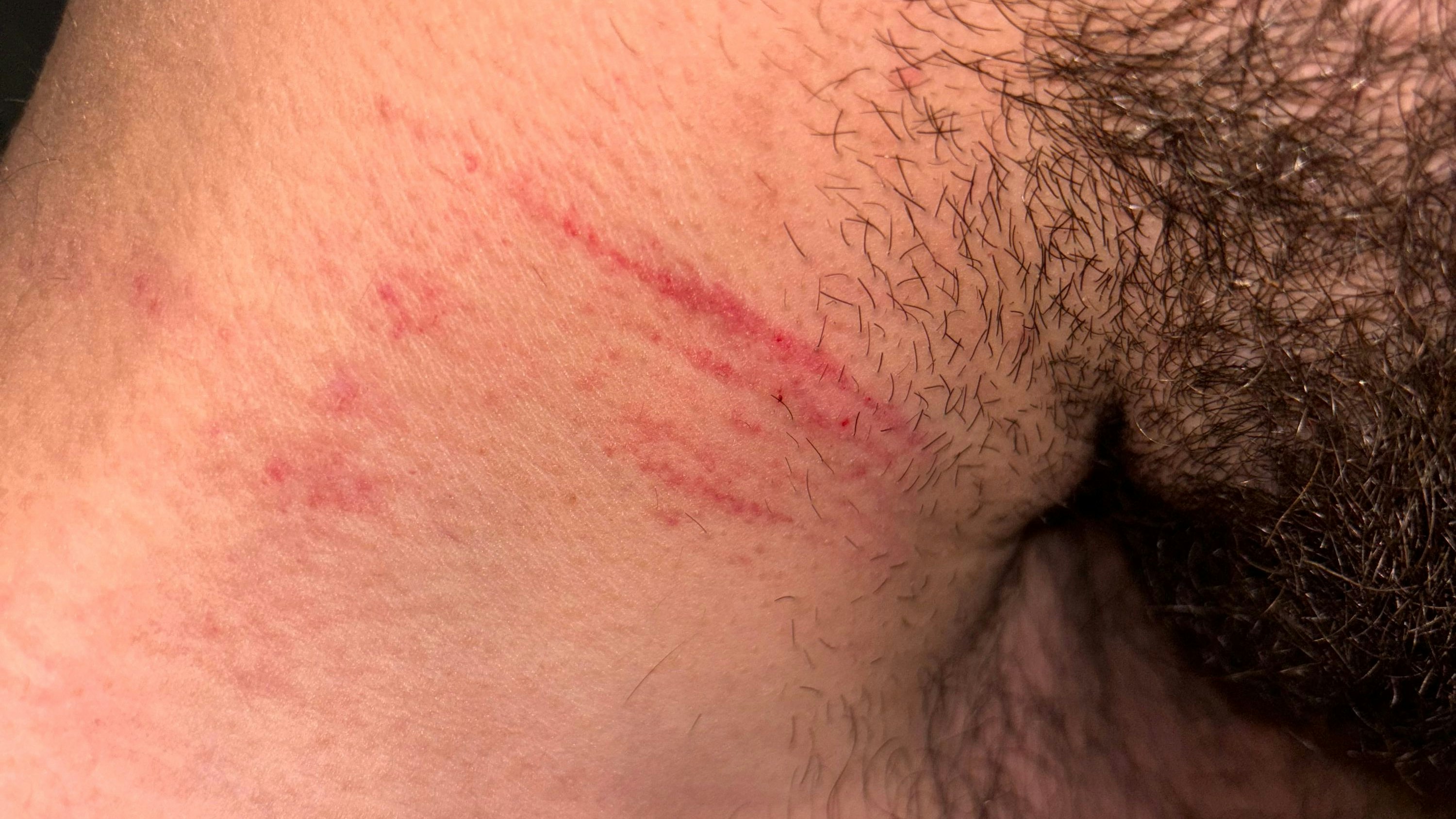 Das Opfer der Attacke erlitt dabei zahlreiche Prellungen.