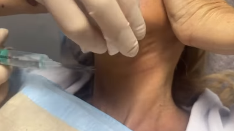 Carmen teilte ein Video, in dem ihre Verletzung am Hals zu sehen ist. Diese musste genäht werden.