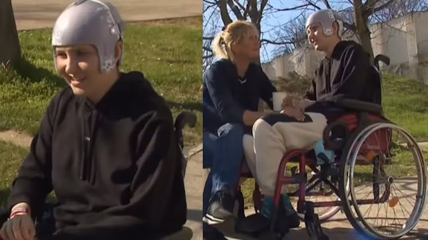 Tereza Nova musste ein Stück ihrer Schädeldecke entfernt werden.