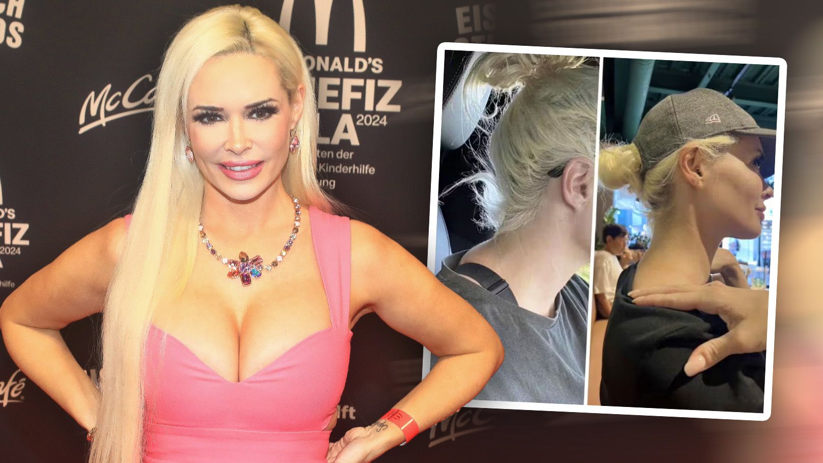 Katzenberger macht kein Geheimnis aus ihren Eingriffen.