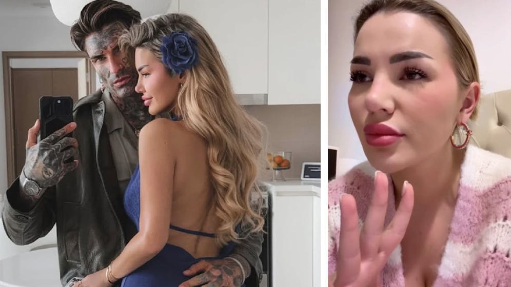Wegen Magentritt? – Kim Virginia hat Baby verloren – Fans sind skeptisch | Heute.at