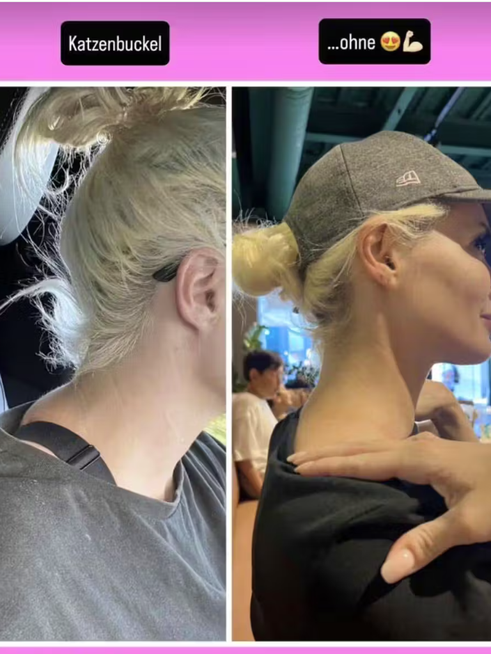 Katzenberger hatte eine OP.