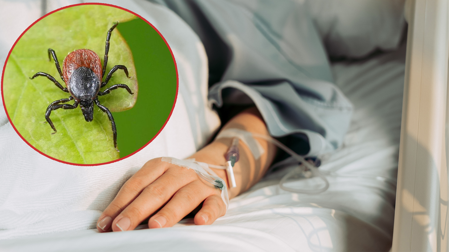 Nur die Impfung schützt vor einer Frühsommer-Meningoenzephalitis (FSME). Wer nicht geimpft ist, riskiert schwere gesundheitliche Folgen.