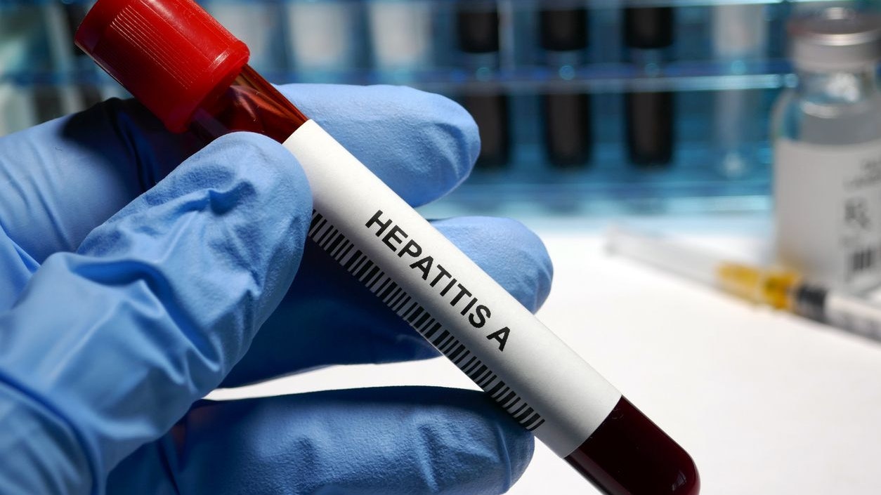 Heute.at - 3 Tote in Österreich! Hepatitis A-Fälle steigen