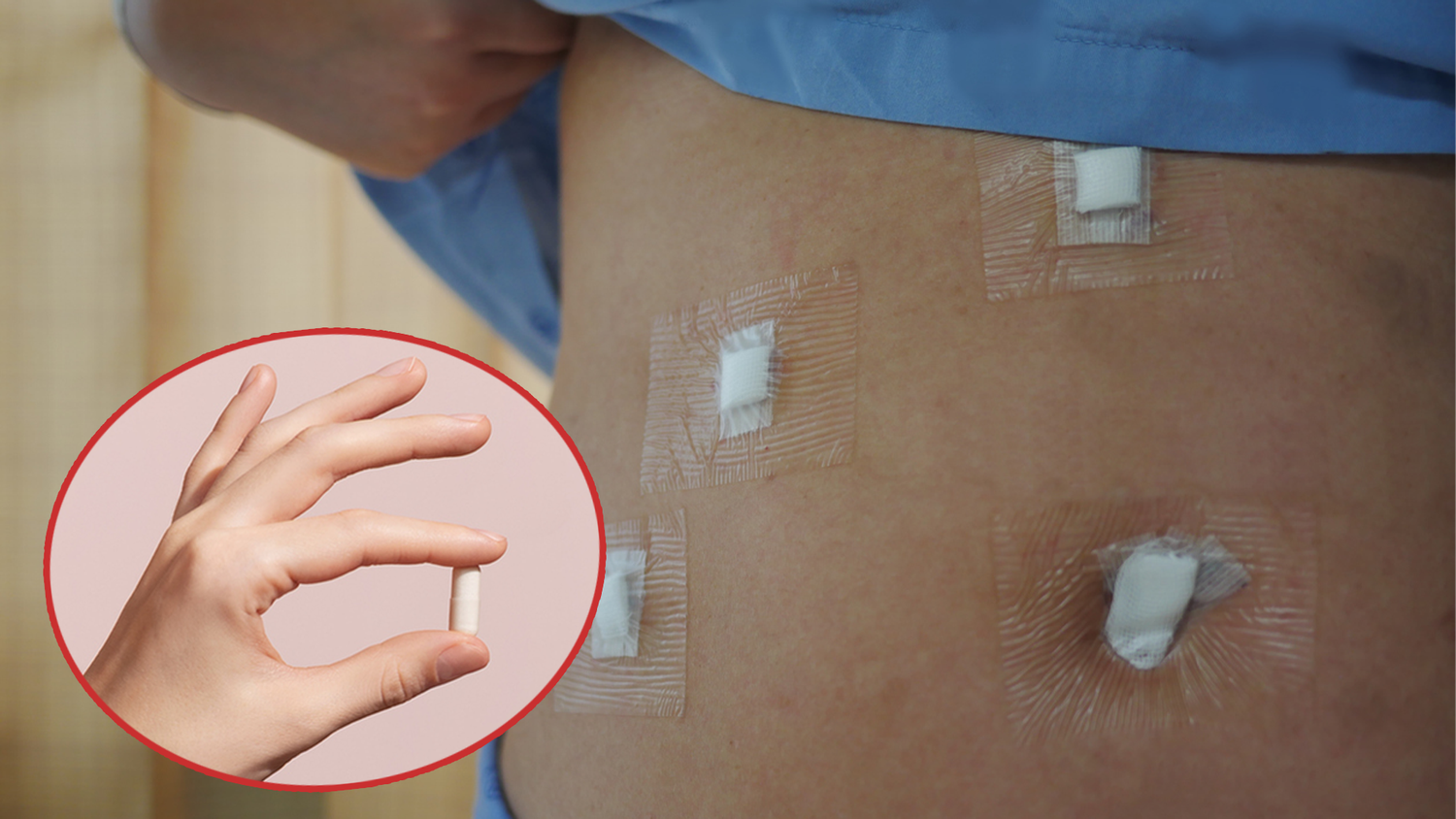 SYNT-101 blockiert vorübergehend die Nährstoffaufnahme im Zwölffingerdarm (dem oberen Teil des Dünndarms) und leitet Nährstoffe in den unteren Dünndarm um. (Symbolbild).