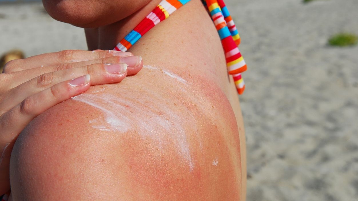 Heute.at - Eine Ausnahme! Da solltest du keine Sonnencreme nehmen