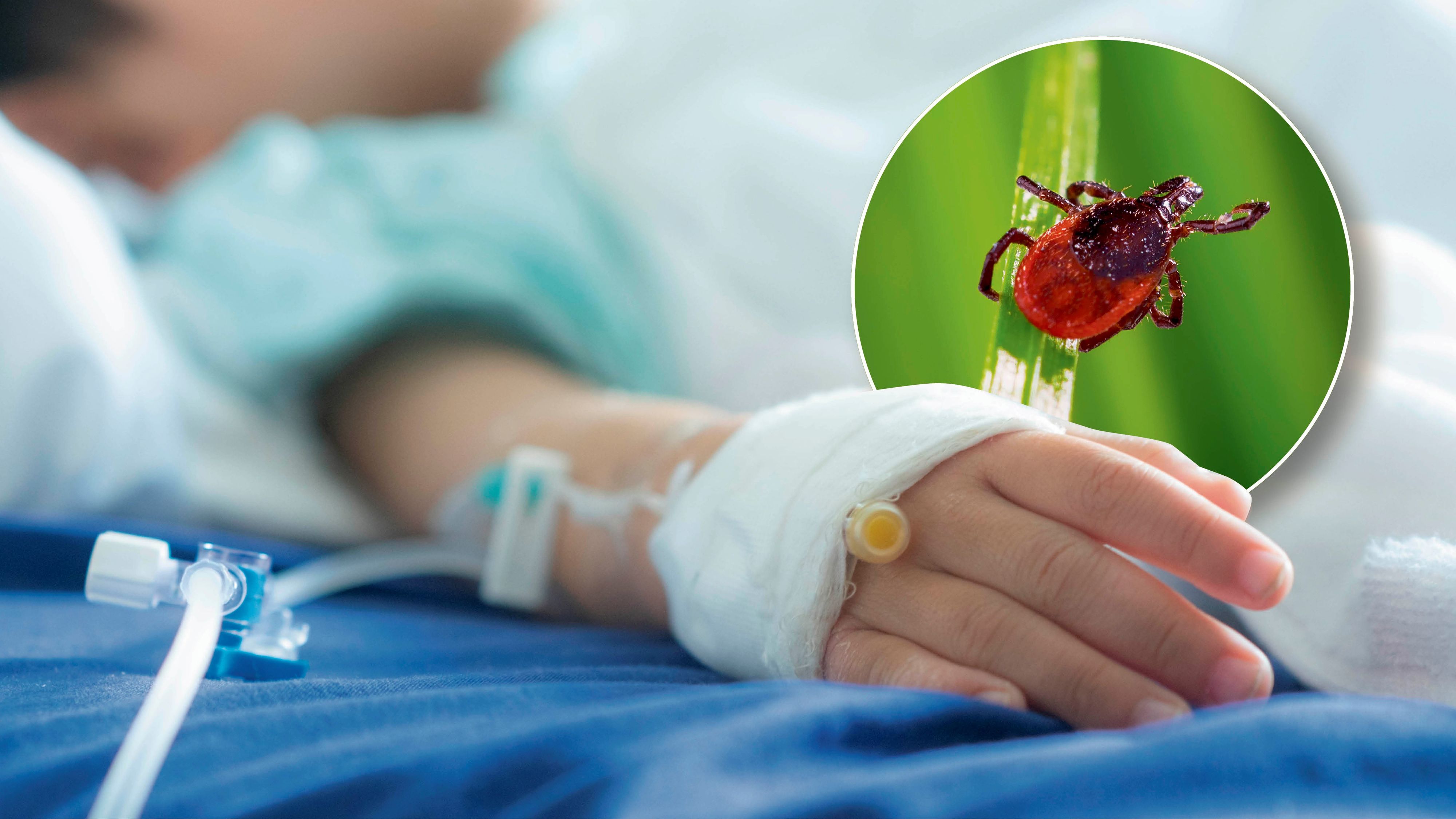 Eine Infektion mit FSME ist nicht zu unterschätzen. Nur Impfen schützt. (Symbolbild)