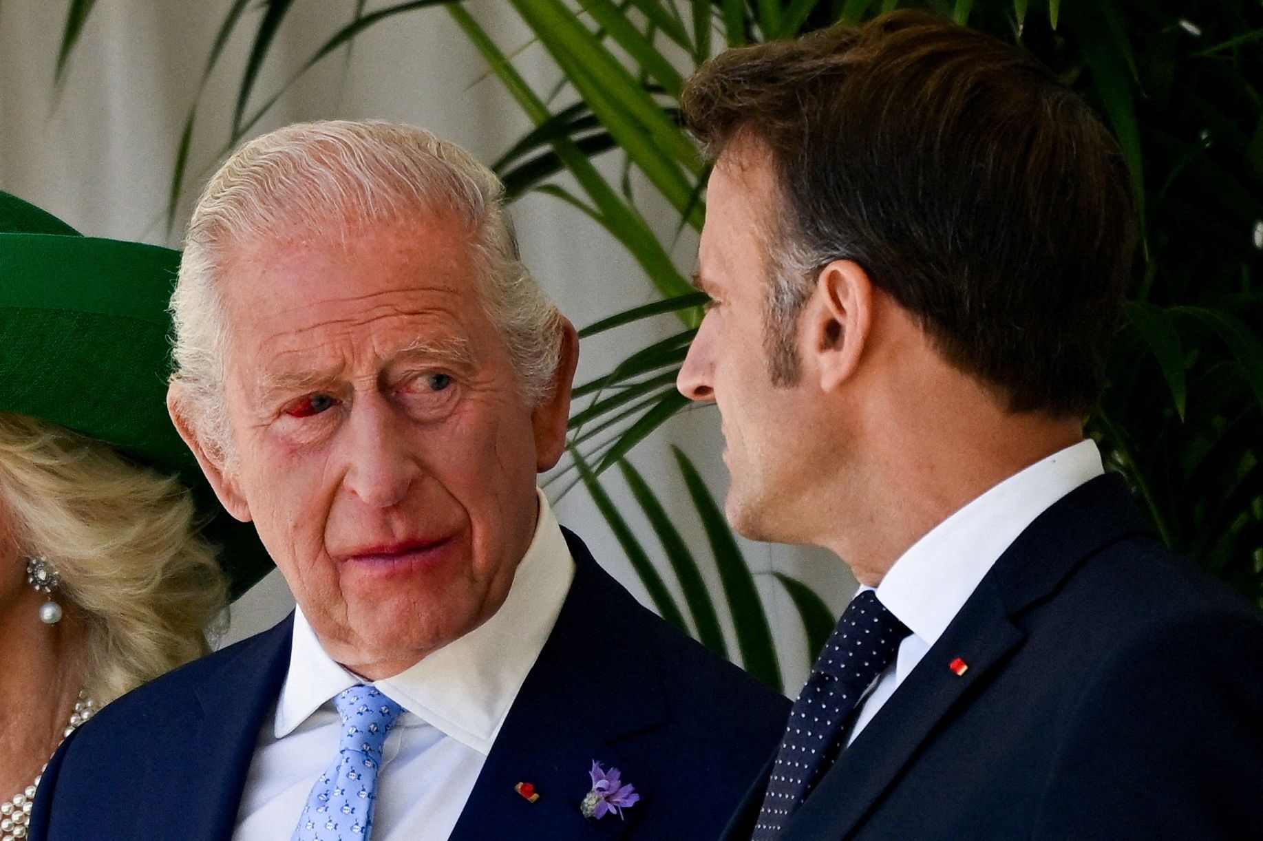 Beim Staatsbesuch von Emmanuel Macron überraschte König Charles mit einem blutunterlaufenen Auge.