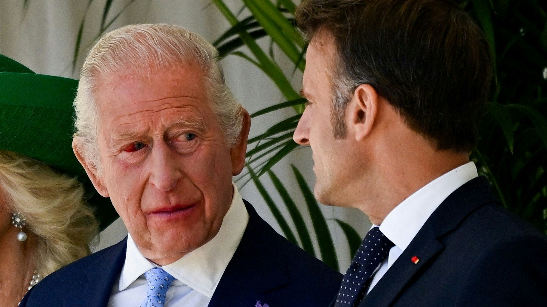 Heute.at - Sorge um Charles!  König hat blutunterlaufenes Auge
