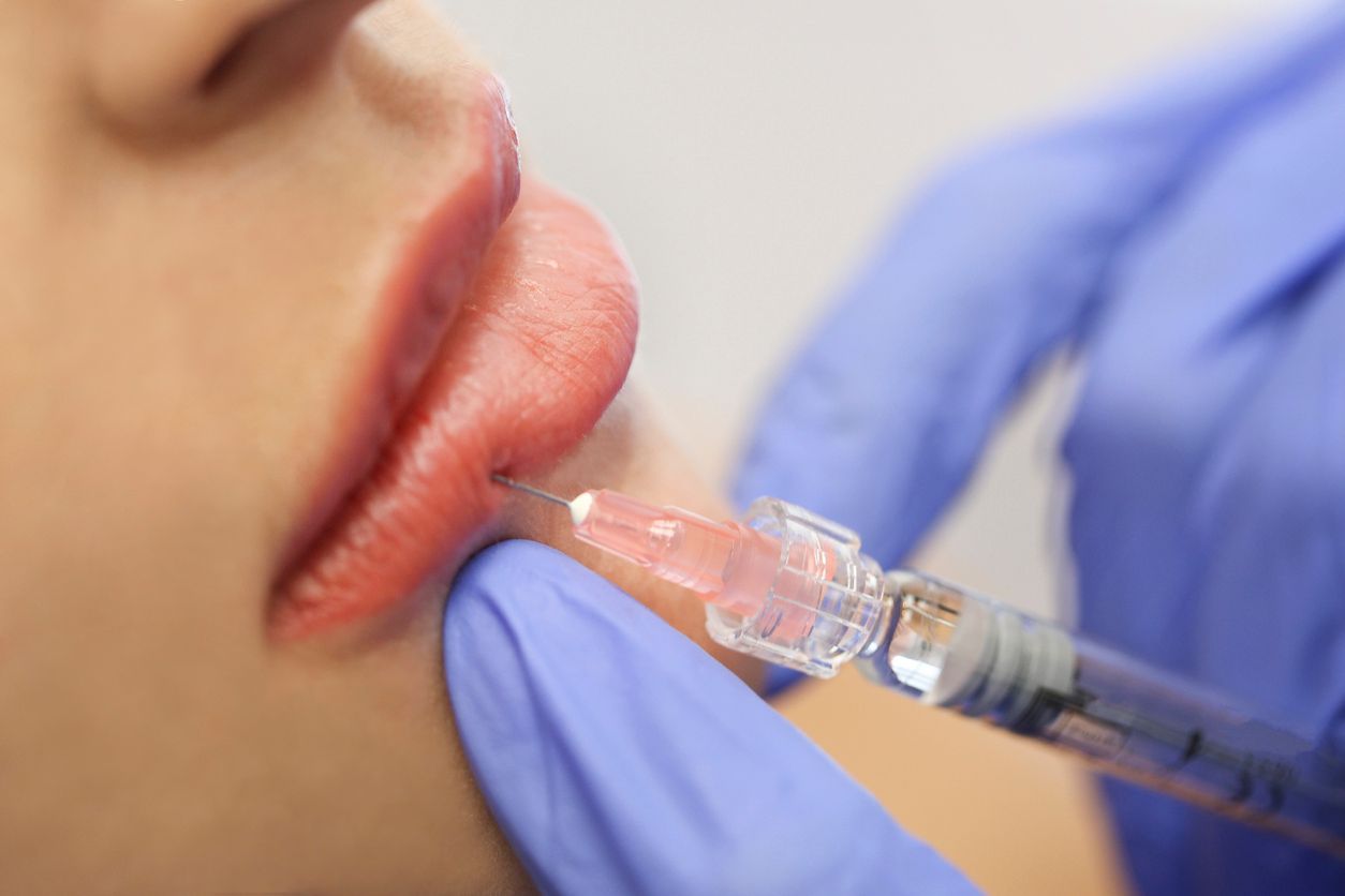 Die Beamten platzten mitten in einen laufenden Eingriff.