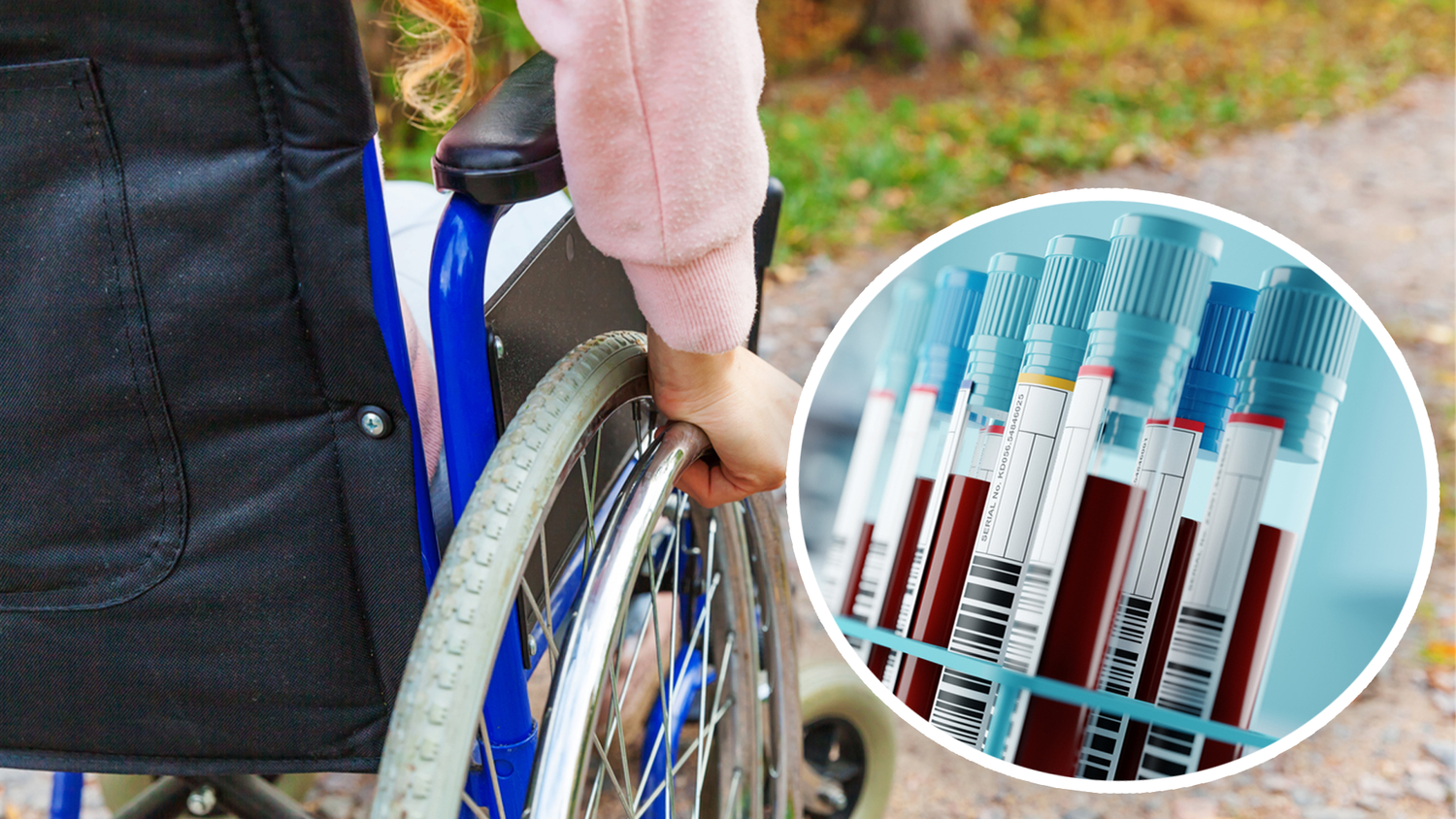 MS verläuft bei jedem Menschen unterschiedlich. Manche sind stärker von Bewegungseinschränkungen betroffen als andere. Neben Rollstühlen können auch Gehhilfen wie Stöcke oder Rollatoren als Übergangslösung oder zur Unterstützung beim Gehen dienen.