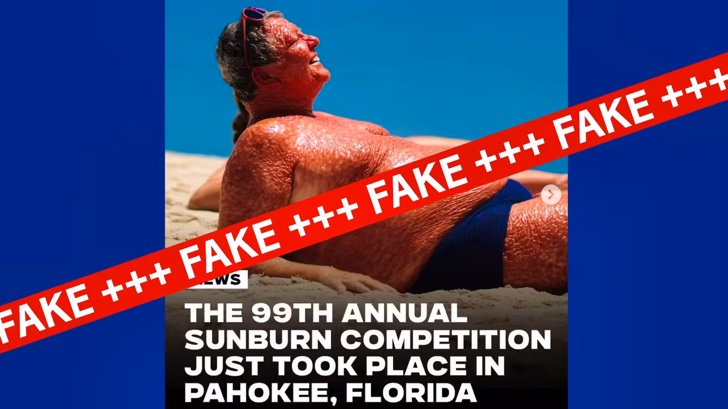 Weder am Bild noch an der Behauptung ist etwas Wahres dran: Es gibt keinen Sonnenbrand-Wettbewerb – weder in Florida noch in anderen US-Bundesstaaten.