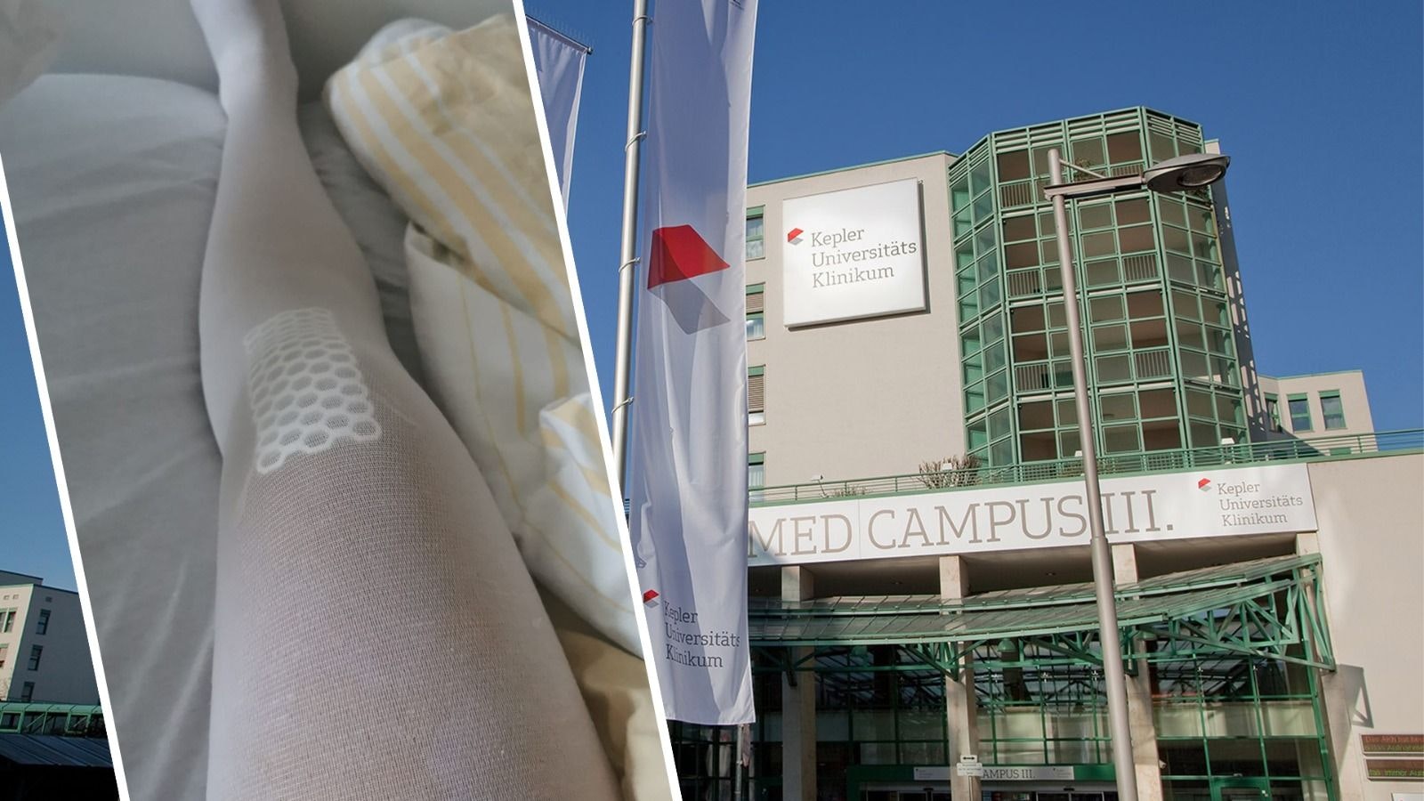 Heute.at - Patienten müssen fast 2 Jahre auf Krampfadern-OP warten