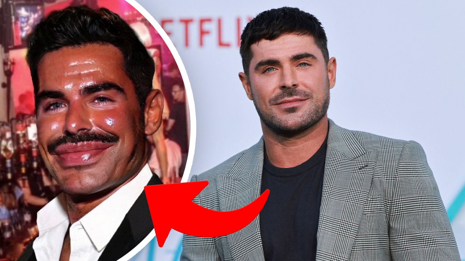 War Zac Efron ein paar Mal zu oft beim Beauty-Doc?