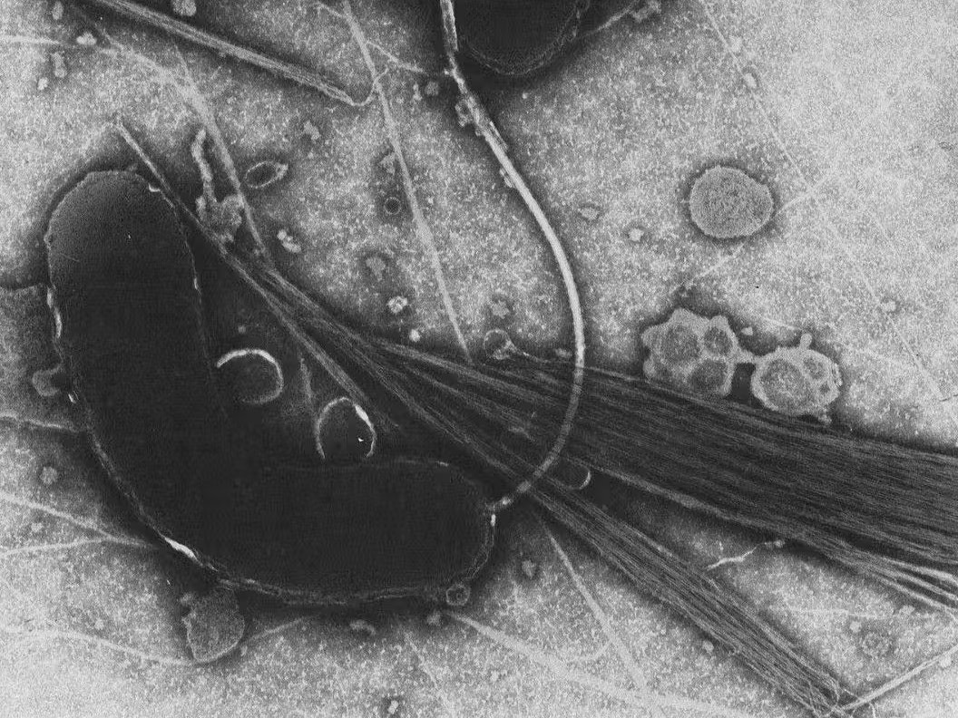 Vibrionen sind gefährliche Bakterien, die sich in warmem Salzwasser vermehren und über kleine Wunden schwere Infektionen verursachen können.