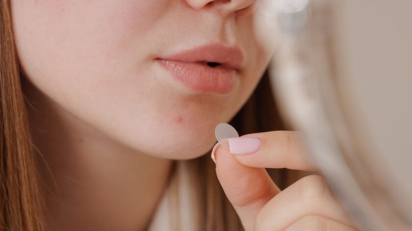 Closeup of a young woman applying a transparent hydrocolloid acne patch on her chin, promoting modern skincare solutions for treating pimples and blemishes with gentle selfcare.