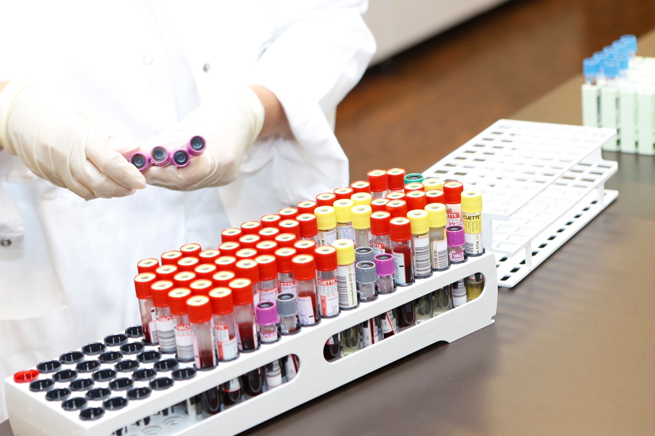 Nicht nur das Leben von Allergikern neue immunologische Therapieansätze verbessert werden.