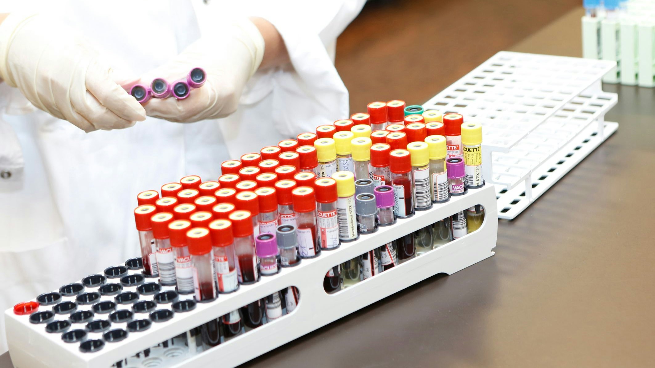 Heute.at - Immunologie-Kongress in Wien weckt neue Hoffnung