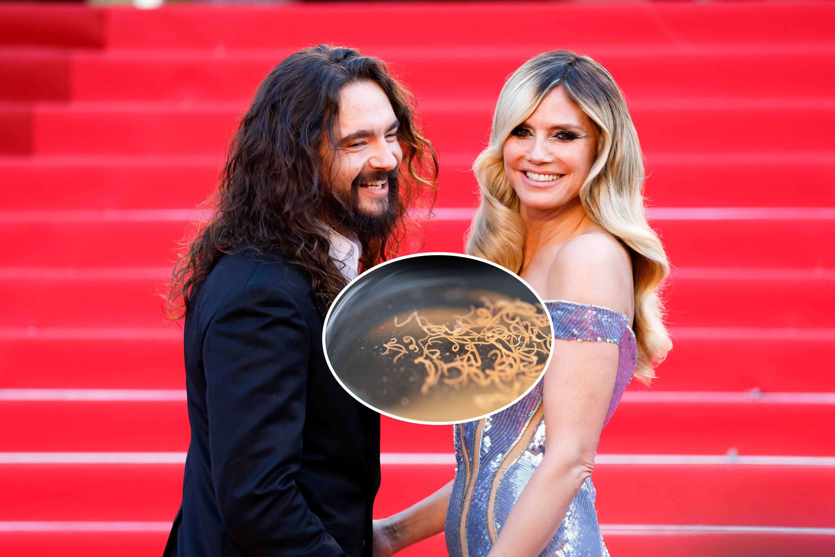 Heidi Klum und ihr Mann Tom Kaulitz machen eine Wurmkur – haben aber sehr wahrscheinlich gar keine Würmer.