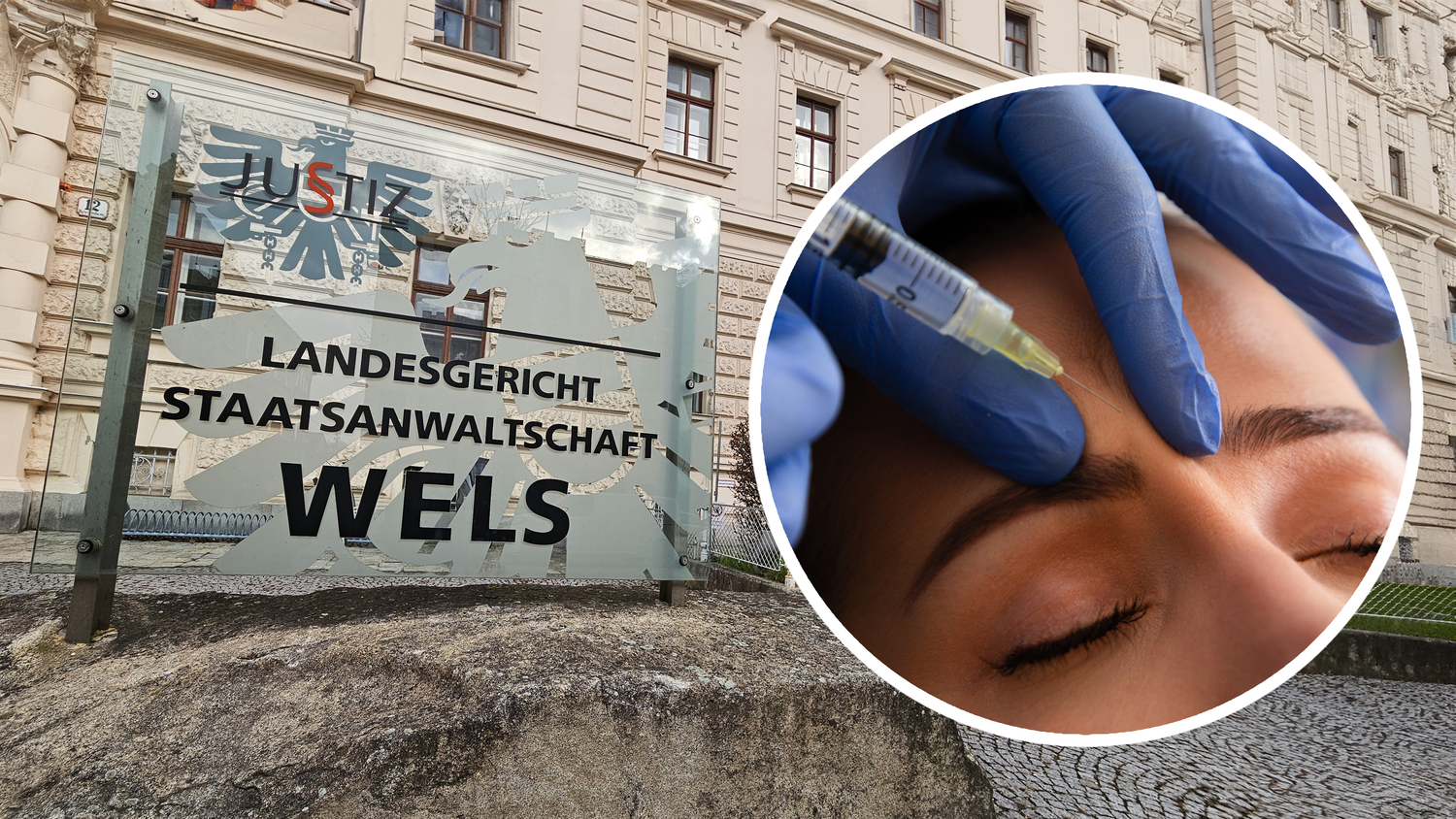 Eine 43-Jährige steht in Wels vor Gericht. Sie soll unter anderem Botox-Behandlungen durchgeführt haben, ohne die entsprechende Ausbildung zu haben. (Symbolbild)