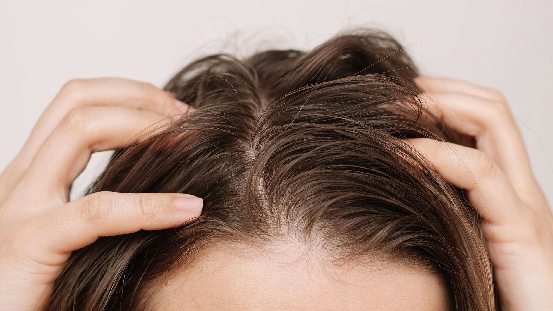 Heute.at - Das passiert, wenn du deine Haare nicht wäschst