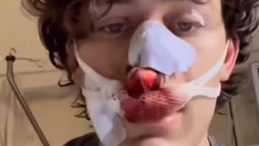 In einem Instagram-Video aus dem Spital erhob der Amerikaner schwere Vorwürfe gegen die deutsche Migrationspolitik.